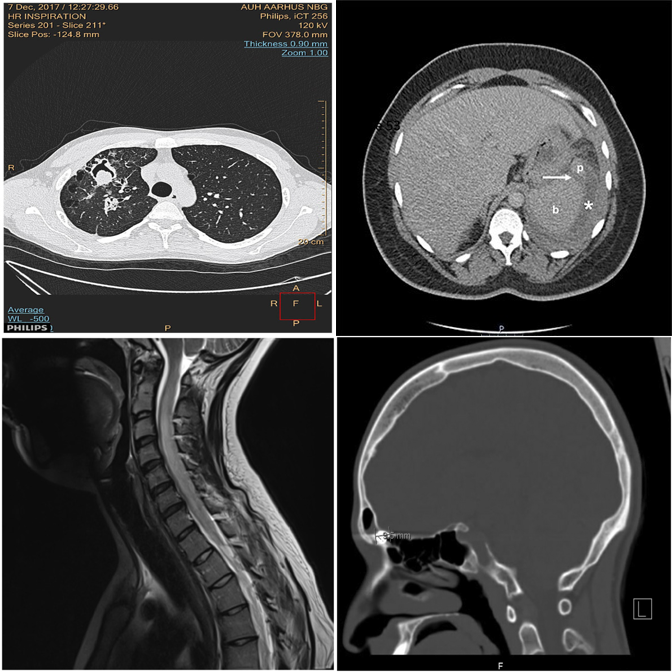 Tier 1 example: MRI vs CT 2×2 grid