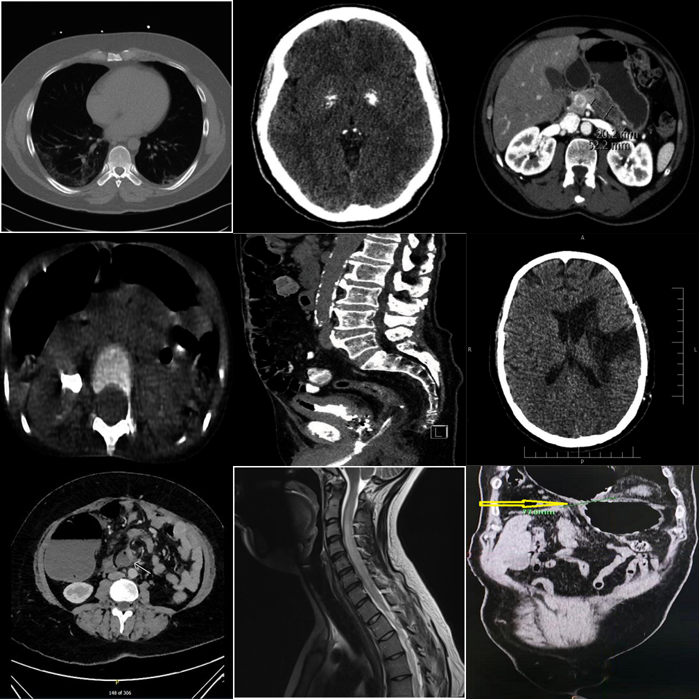 Hard case example grid