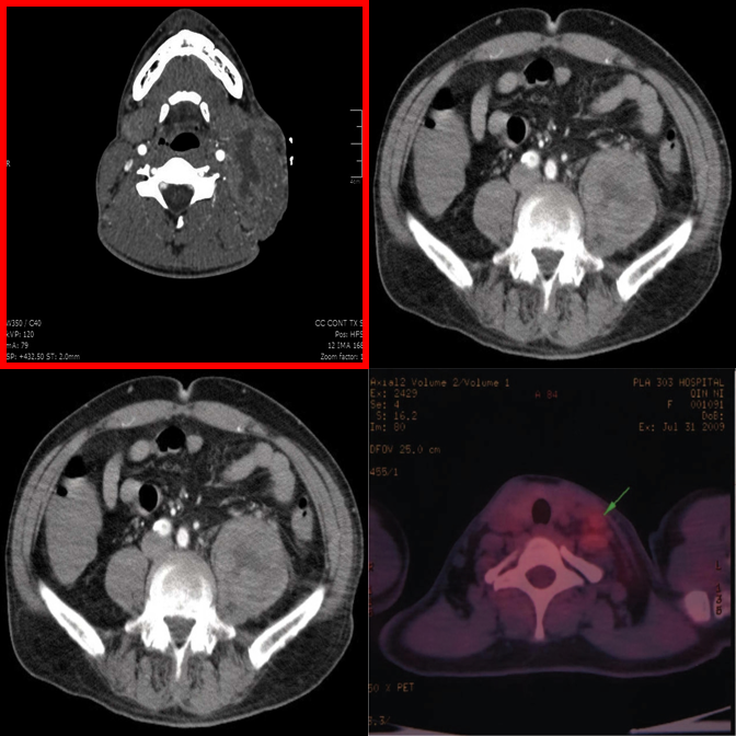 Example 6 — Visual Referring negative