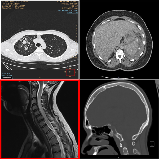 Example 5 — Visual Referring with red box