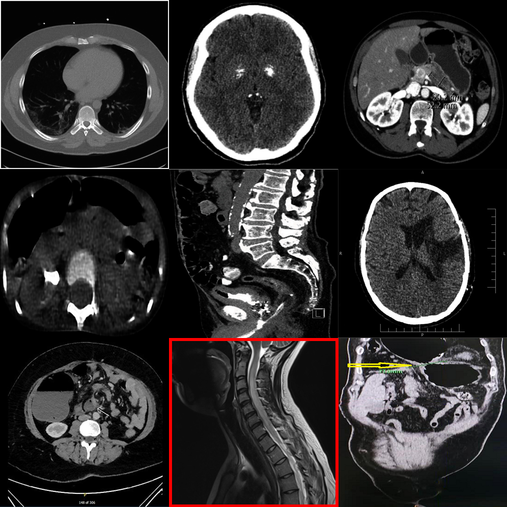 Example 8 — Visual Referring 3×3