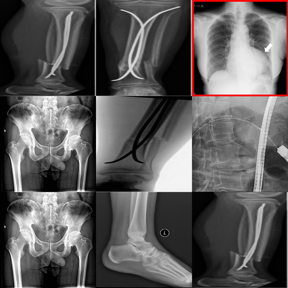 Example 9 — Visual Referring negative